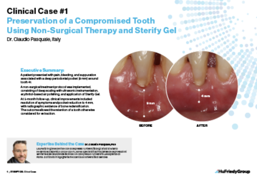 Preservation of a Compromised Tooth Using Non-Surgical Therapy and Sterify Gel