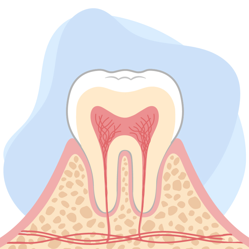 Contributes to decreasing pocket depth